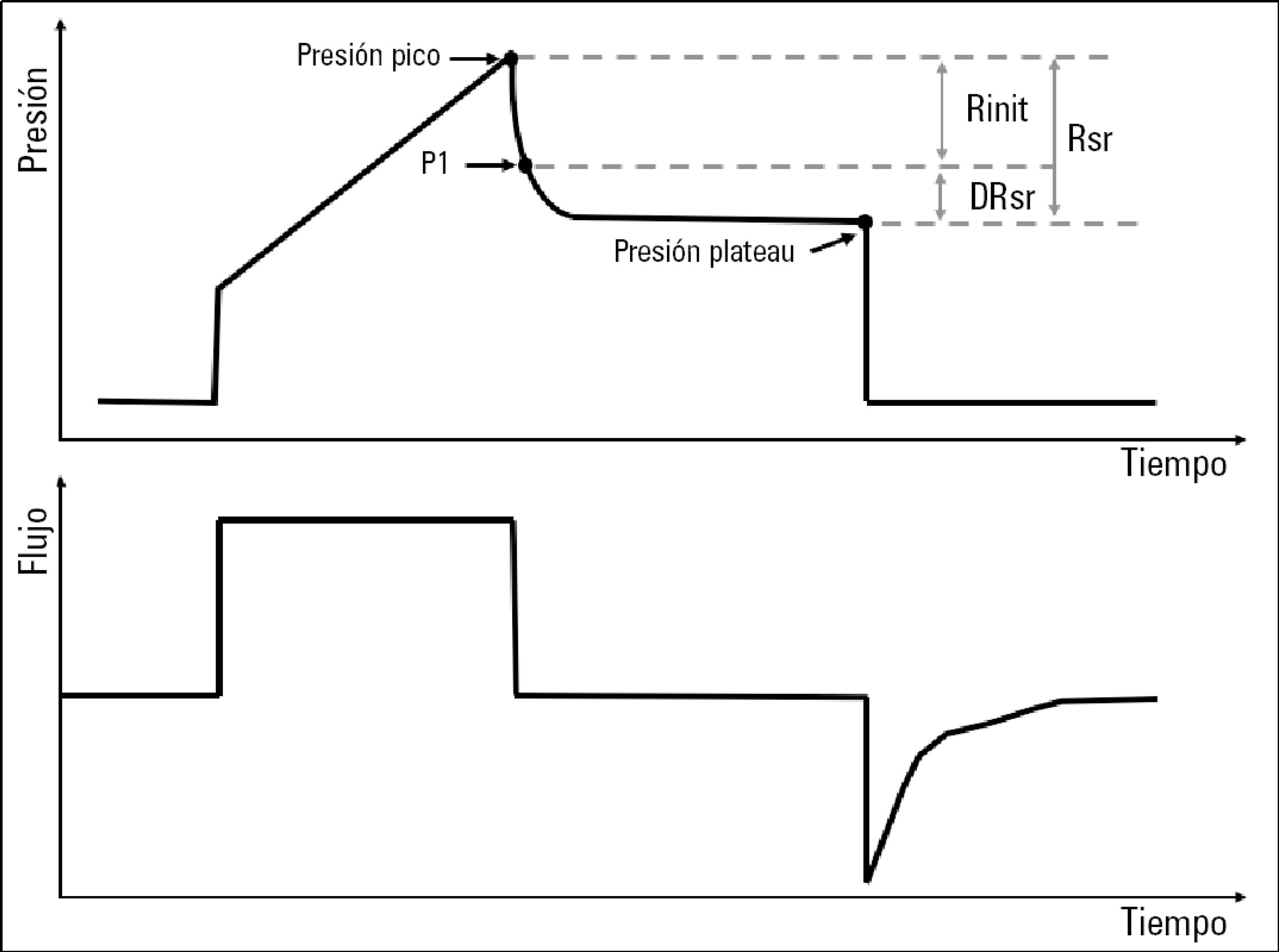 Grafica de presión control por volumen